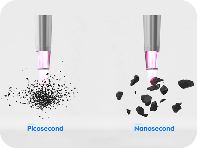 ピコレーザーのフォトメカニカル効果