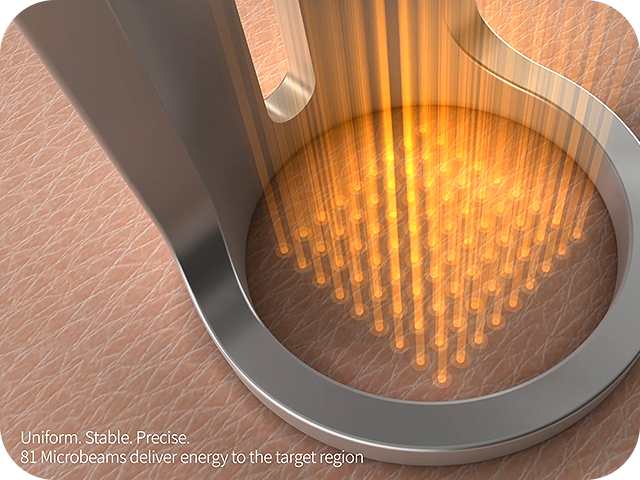 DOE フラクショナル テクノロジー