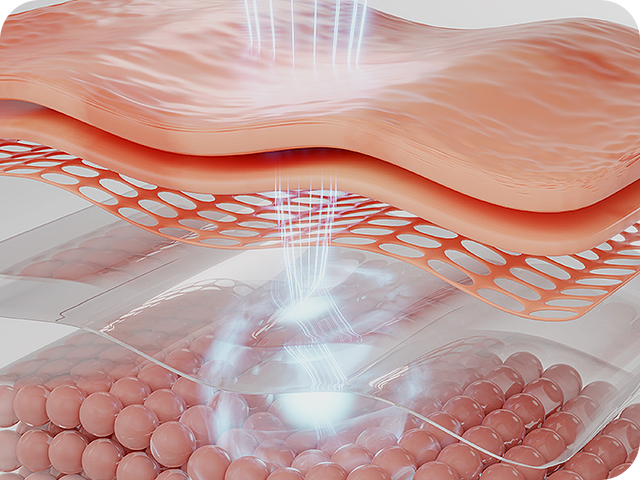 열 렌즈 보정 기술